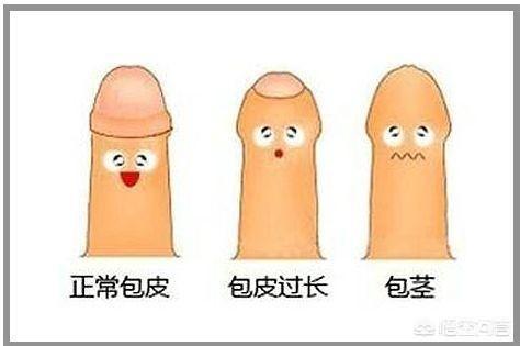 割包好处和坏处:小孩几岁最适合做包皮手术