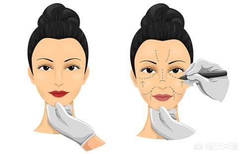 眼部吸脂手术(眼部吸脂手术的价格)