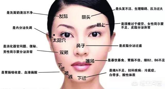 头条问答 我的下巴老长痘 嘴周围痘痘不断 怎么 36个回答