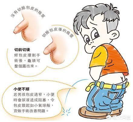 割包好处和坏处:小孩几岁最适合做包皮手术
