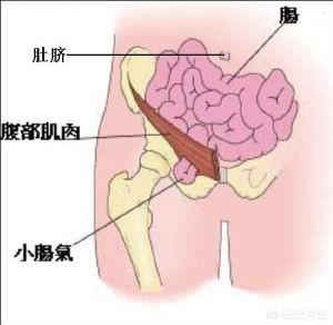 头条问答 - 50岁的人小肠疝气术后要注意哪些?(12个回答)