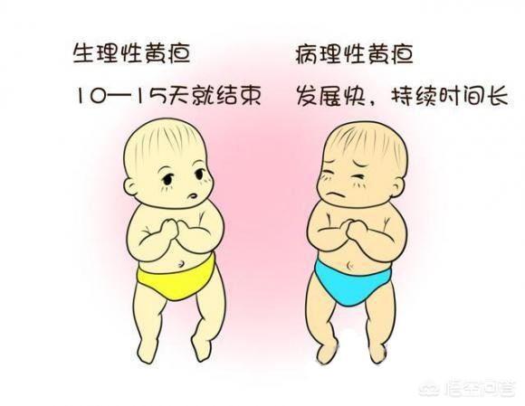 治疗新生儿黄疸病:宝宝40天有黄疸该怎么办？