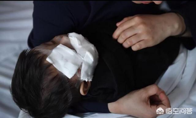 被狗咬伤险些毁容:1岁娃小区玩耍脸被狗咬毁容，缝了百余针，你怎么看？