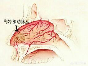 秋季鼻孔干燥出血:秋冬季节嘴唇干，鼻子也干，爱流鼻血是怎么回事？