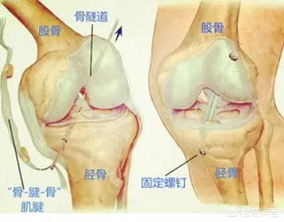狗狗十字韧带断裂表现:前交叉韧带撕裂，是什么级别的伤病，恢复需要多久？