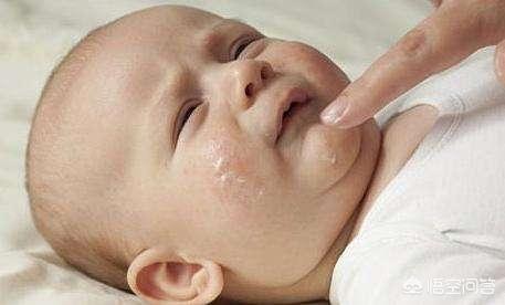 婴儿患湿疹，一般是什么样子的？