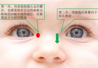 新生儿眼屎多:新生儿眼屎多且黄还黏稠怎么回事？