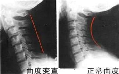 脚麻怎么回事-脚麻是什么原因引起的,怎么解决