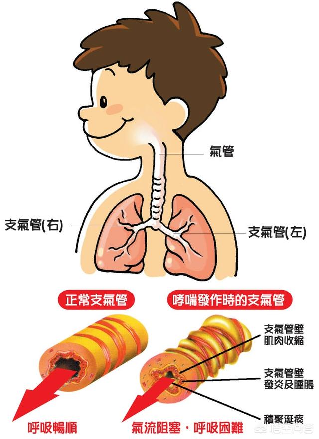 支气管炎的位置图片图片