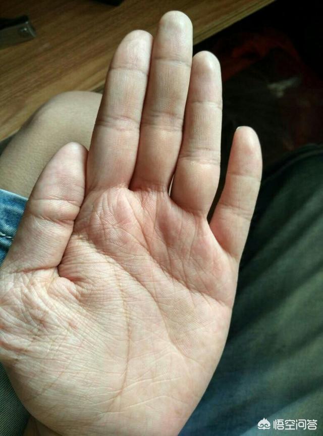 掌纹是如何形成的？