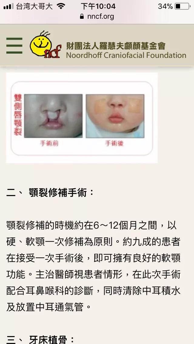 头条问答 如果怀孕3个月时做四维发现孩子有兔裂唇 你还会要么 淡泊的糯米d的回答 0赞