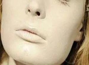 贫血会怎么样怎样知道自己是不是贫血缺铁性贫血怎样调理