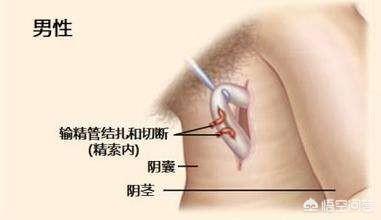 绝育黄瓜安全事情:黄瓜“炭疽病”如何预防及治疗？