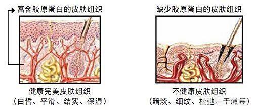 喝茶对皮肤好吗,皮肤表面干燥，是不是和喝茶叶水有关系呢？