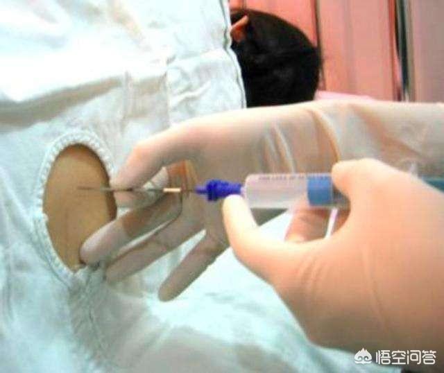 石家庄男子活剖孕狗拍视频:剖腹产打麻药是什么样的体验？