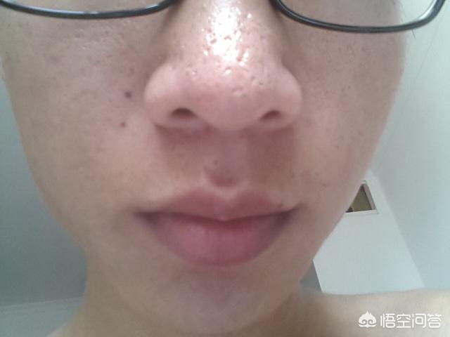 如何收缩鼻头毛孔(鼻头上的毛孔洞怎么收缩)