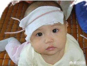 孩子发烧的时候可以吃水果吗？