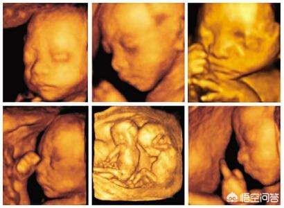 怀孕7个月四维彩超;七个月胎儿四维彩超图片