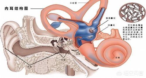 蒙淘克怪兽是怎么回事:耳石症是什么，它有哪些症状？