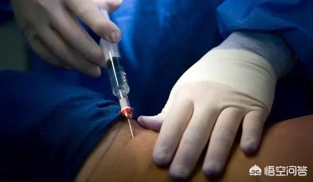 脑瘤手术麻醉后遗症:作手术时选择全麻会对记忆力造成影响吗？