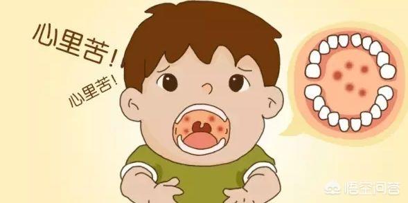 小儿急性喉炎几天能好，宝宝患疱疹性咽炎，大概多久能好