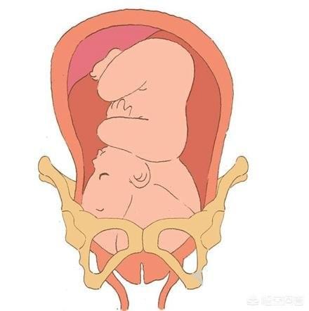 头条问答 - 怀孕31周会入盆吗,胎儿最早入盆是第几周?(9个回答)