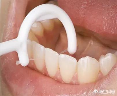 怎么去牙石：怎样去除牙石的简单方法