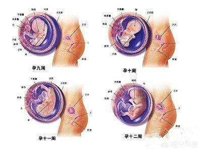 怀孕3个月胎儿成形了吗，怀孕3个月胎儿成形了吗需要注意哪些问题