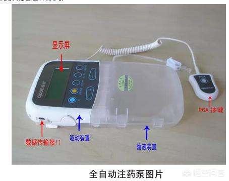 全麻拔牙术后用镇痛泵吗:术后如何镇痛？用口服镇痛药吗，会成瘾吗？