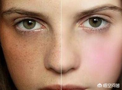怎样去除黄褐斑小妙招:38岁女人很多黄褐斑，怎么去脸上的黄褐斑有效？