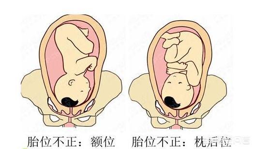 孕35周了,胎位定了吗?(6个回答)