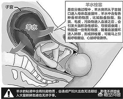 张铁泉是否己死亡:小偷去人家偷牛，被牛顶死了，养牛户负法律责任吗？