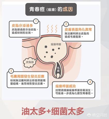 肉豆蔻酸洗面奶有哪些坏处，有什么真实有效的祛痘方法