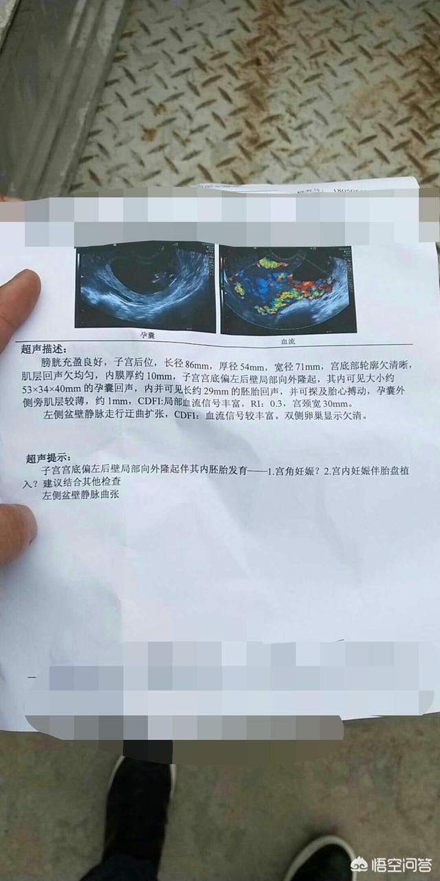宫外孕的表现,宫外孕有什么征兆多久能查出来？