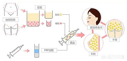 怎么治抬头纹(怎么治抬头纹视频)