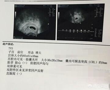 头条问答 怀孕7周 B超单孕囊只有一个数据 正常吗 12个回答