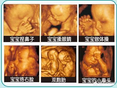 怀孕7个月四维彩超;怀孕7个月四维彩超看男女