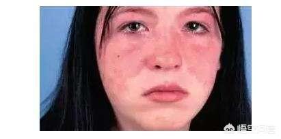 身体差,怎么增强免疫力？