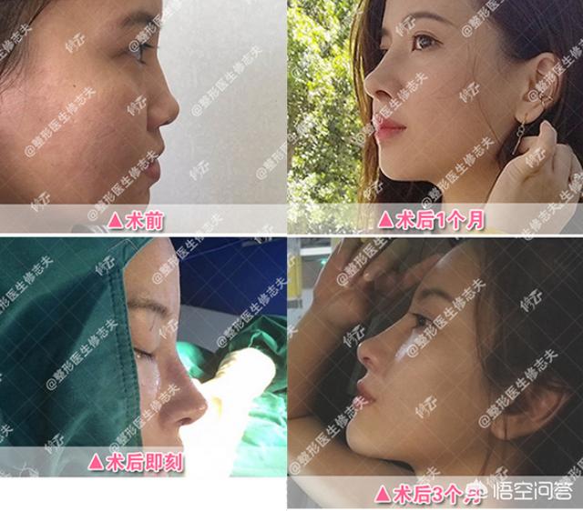 脸部整形美容(脸部美容多少钱)
