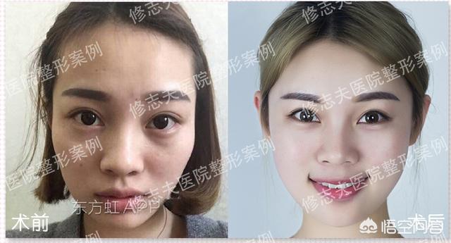 脸部整形美容(脸部美容多少钱)