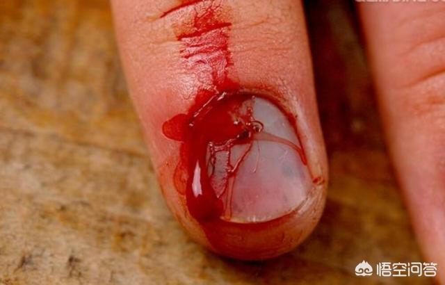 头条问答 - 手不小心流血了,用嘴吸进肚子里能补回来吗?(10个回答)