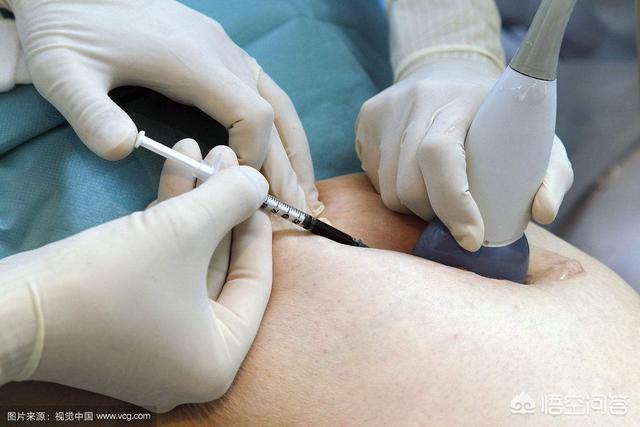 头条问答 - 皮下,静脉,腹腔,如何选择正确的注射方式?(1个回答)