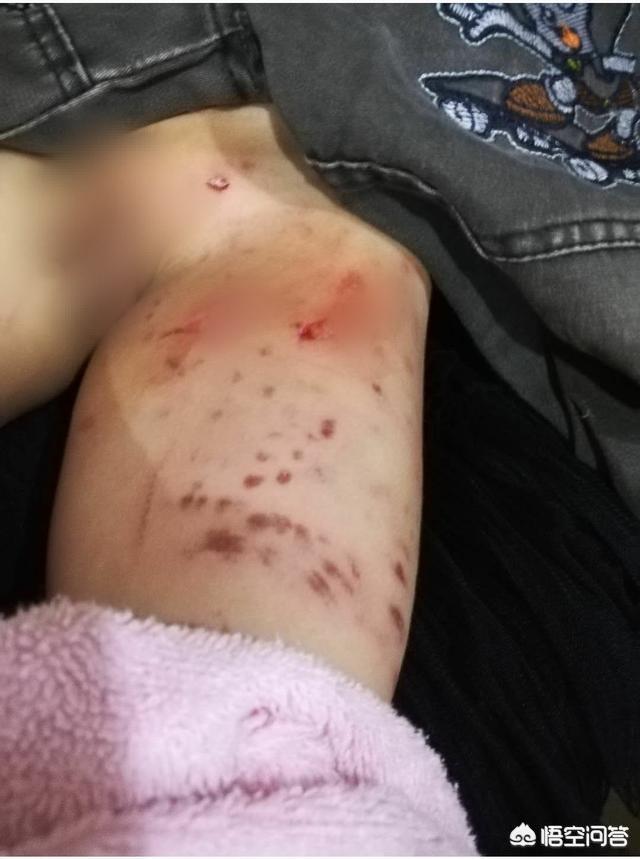 狗狗卖娃事件:12岁女孩偷邻居家的狗出来玩，却害死八旬老太，邻居要负责吗？
