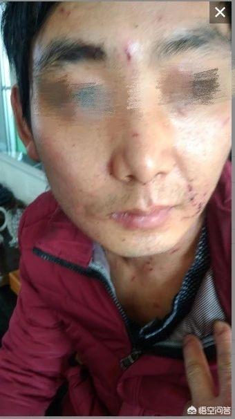 张培萌妻子称被家暴:男子婚内强奸老婆和家暴有何区别？