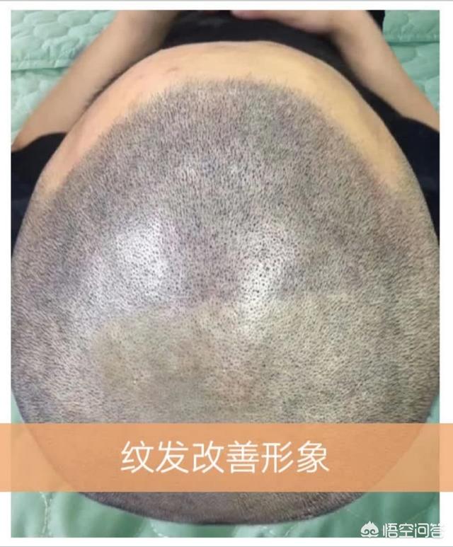 纹发多少钱？