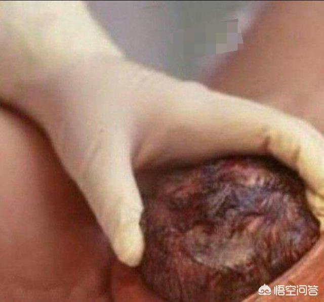 产前预兆:顺产前有什么征兆？该做哪些准备？