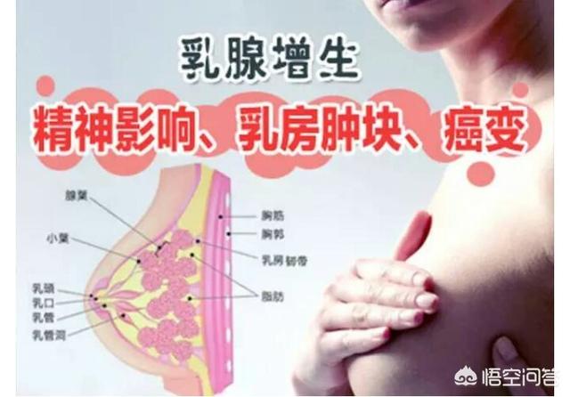 头条问答 乳腺肿块不一定是乳腺癌 可能是乳腺疾病 两者之间该如何区分 欧阳黎黎的回答 0赞