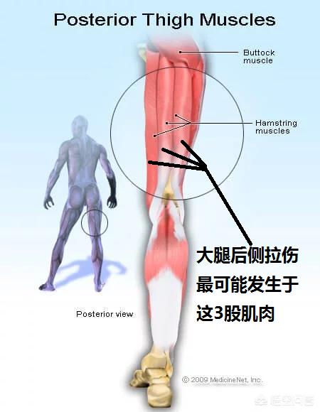 头条问答 保罗腿筋拉伤是个什么样的伤病 最少需要休息多久 能不能赶上总决赛复出 王栋聊健身的回答 0赞