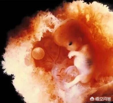 孕两月老是有褐色分泌物:先兆流产信号别怠慢，早孕出现褐色分泌物，如何应对？