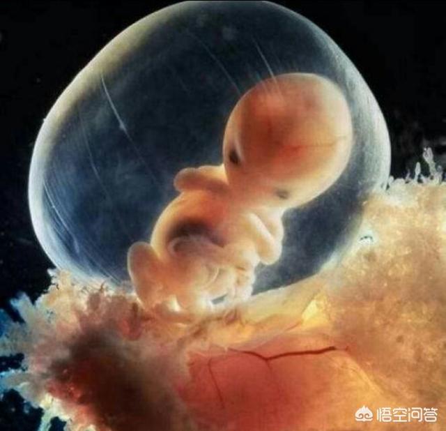 四个月胎儿图男孩图片